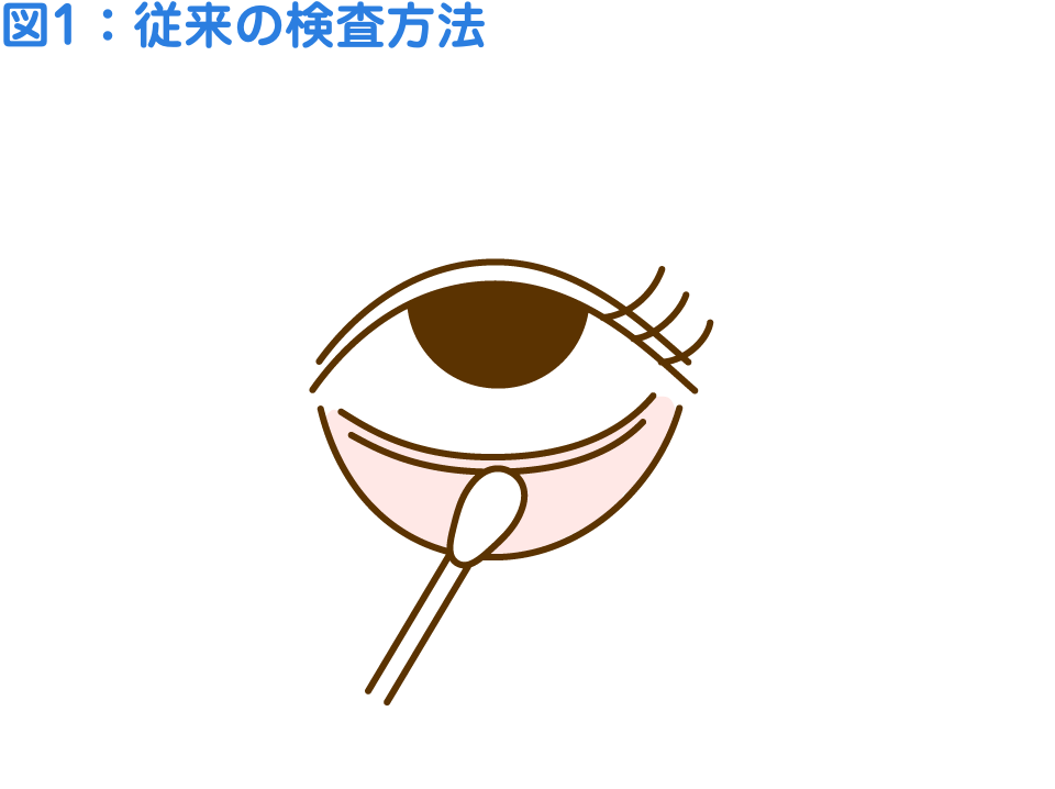 従来の検査方法